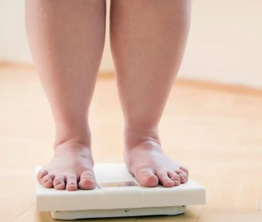 Влияние ожирения на варикозные вены нижних конечностей