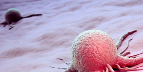 Почему злокачественные опухоли называют раком