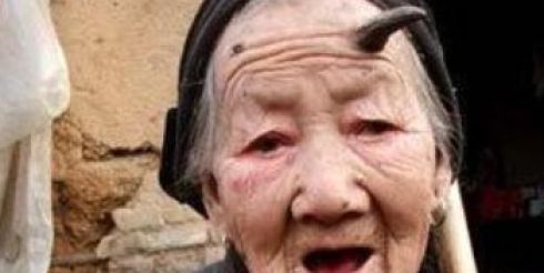 Рог на лбу 101 китаянки (фото)