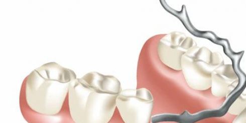 Недорогое протезирование зубов в стоматологическом центре «Эксперт»!