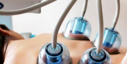 Аппаратный вакуумный массаж