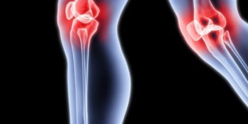 Болезнь Осгуда-Шлаттера: симптомы и лечение