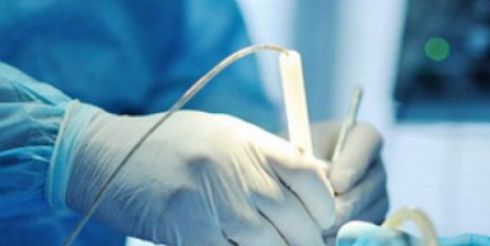 Биопсия: существующие виды и особенности проведения