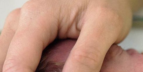 Кесарево сечение негативно влияет на развитие головного мозга